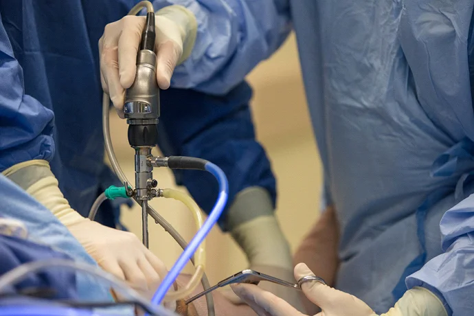 آرتروسکوپی زانو چیست؟