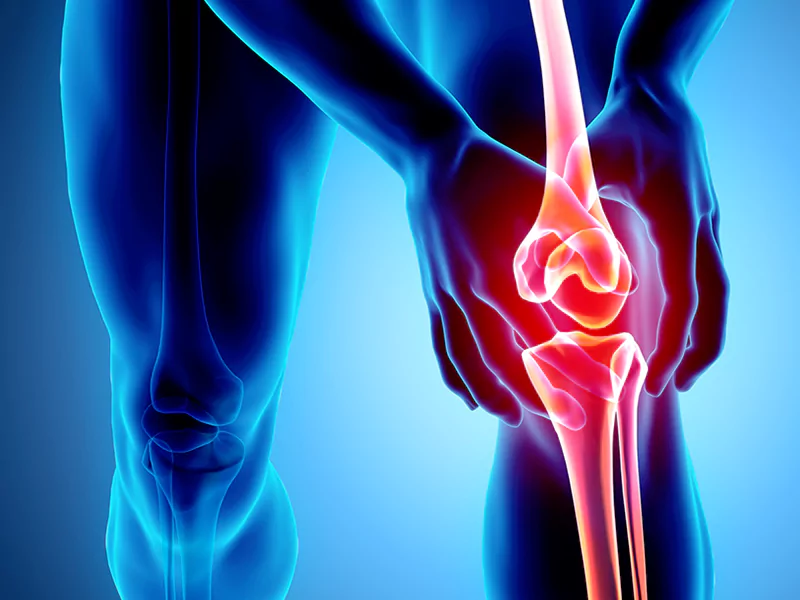 شکستگی مفصل زانو