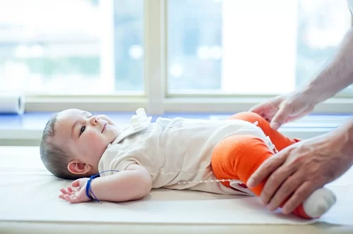 درمان در رفتگی لگن در کودکان