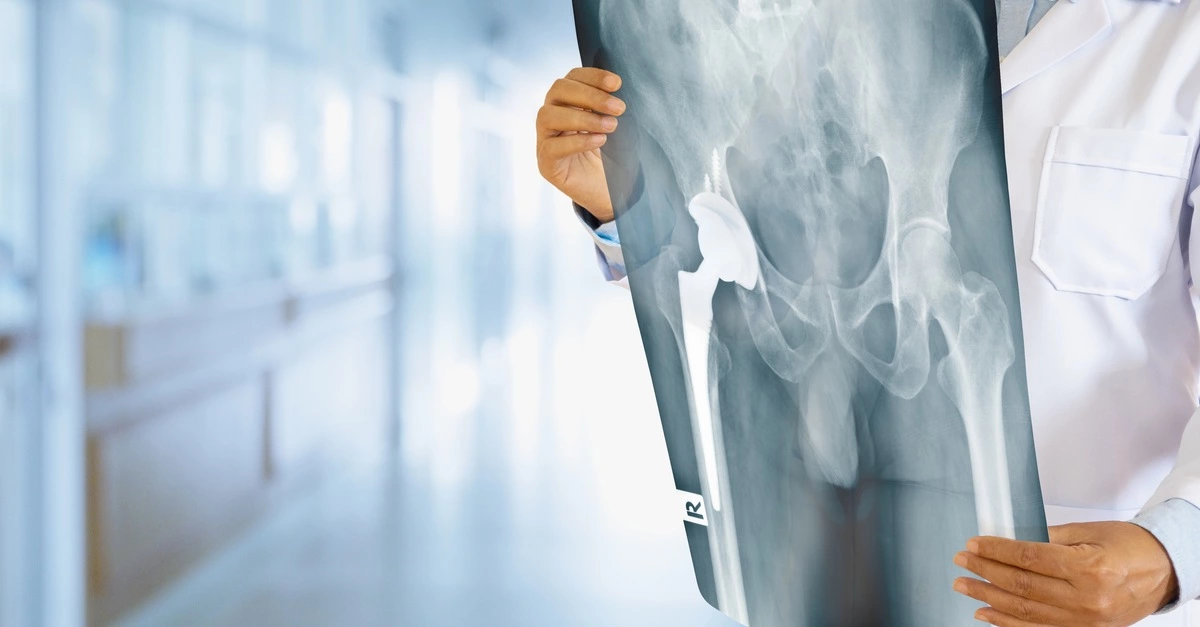 بهترین جراح تعویض مفضل لگن