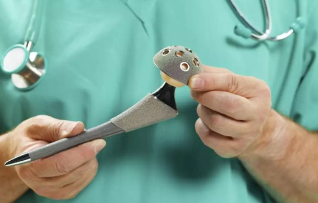 بهترین جراح تعویض مفصل زانو