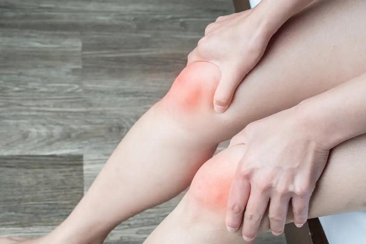 علائم زانوی ناپایدار