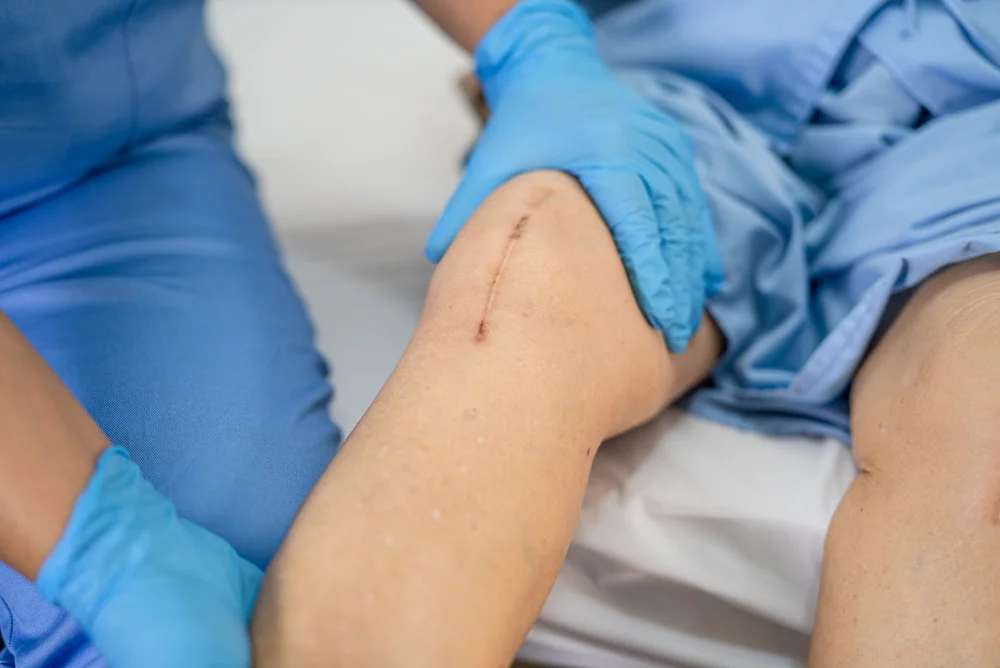 سن مناسب جراحی تعویض مفصل زانو