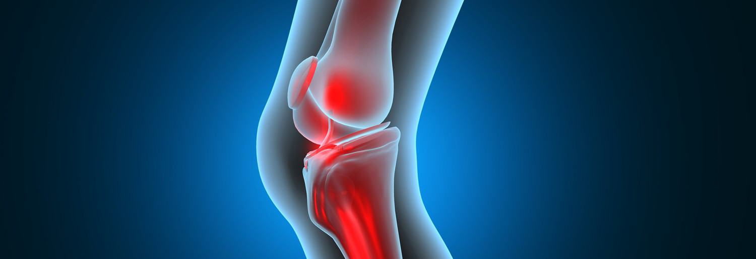 پارگی صلیبی