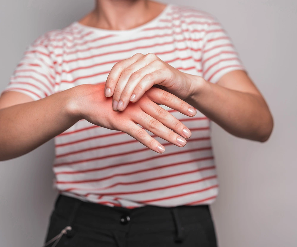 بیماری پروانه‌ای